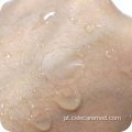 Acne invisível de capa de acne hidrocolóide